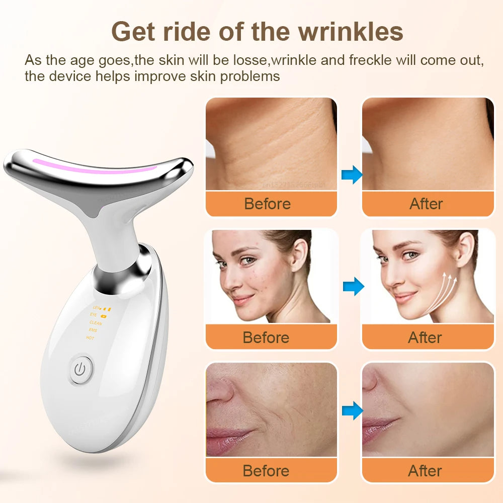 Masajeador facial eléctrico micro esculpido, eliminación de arrugas, lifting facial