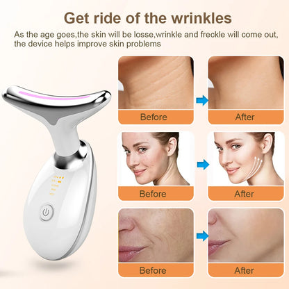 Masajeador facial eléctrico micro esculpido, eliminación de arrugas, lifting facial